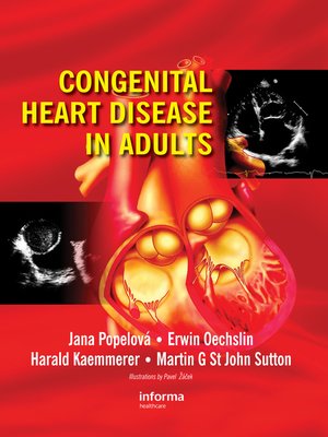 cover image of Congenital Heart Disease in Adults